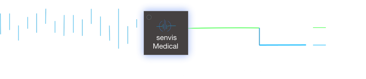 Vibration to Detection process